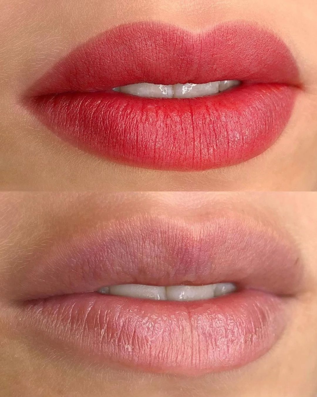 Comparativa de labios, caso 1
