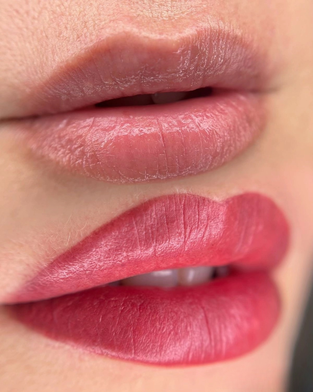 Comparativa de labios, caso 3